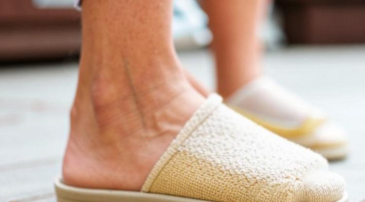 Незаметный, но опасный. Почему тромбоз помолодел