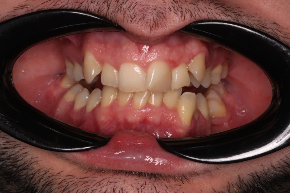 ����������� �����: ������ �������� ������ ����� ������������